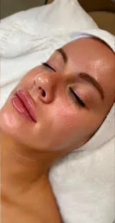 after-before-hydrofacial