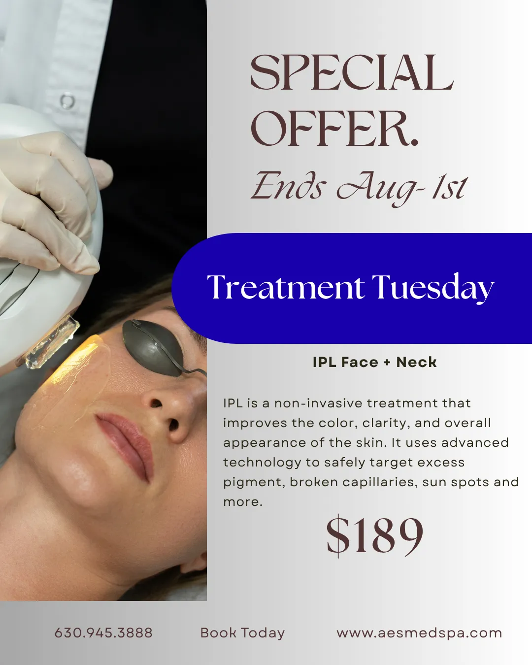 Treatment Tuesday June Special at AES Med Spa featuring VI Peel and Dermaplane treatment in St. Charles IL for brighter, smoother, rejuvenated skin.