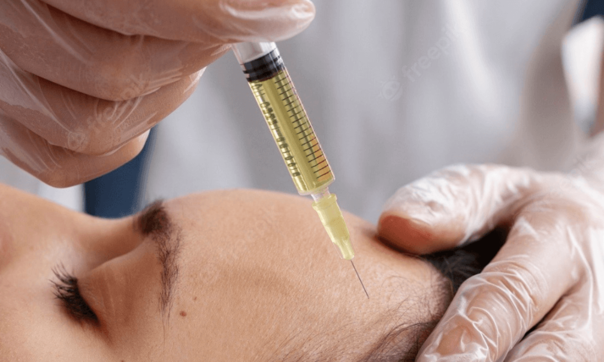 PRP injection treatment at AES Med Spa in St. Charles
