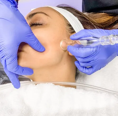 Signature Lymphatic Sculpt Facial treatment at AES Med Spa in St. Charles