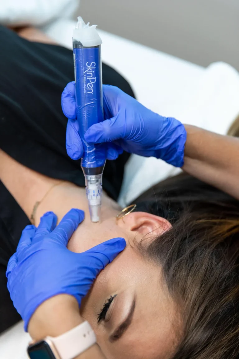 SkinPen® Session