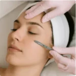 Dermaplaning